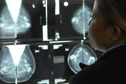 Woman Looking at Mammogram Films